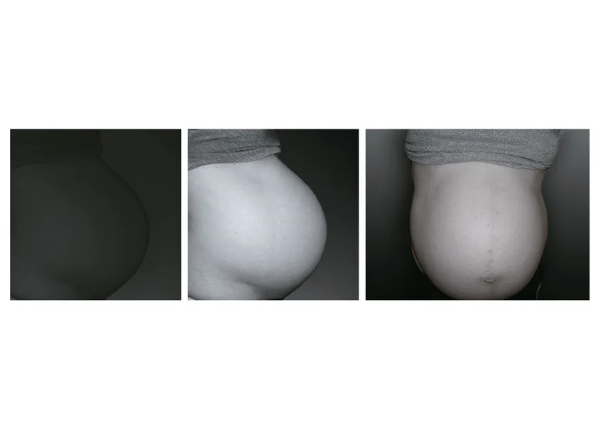 Photo series I, 2011 — 4